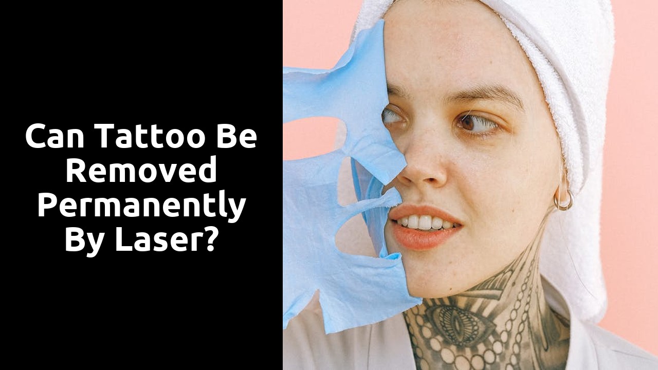 Can tattoo be removed permanently by laser?