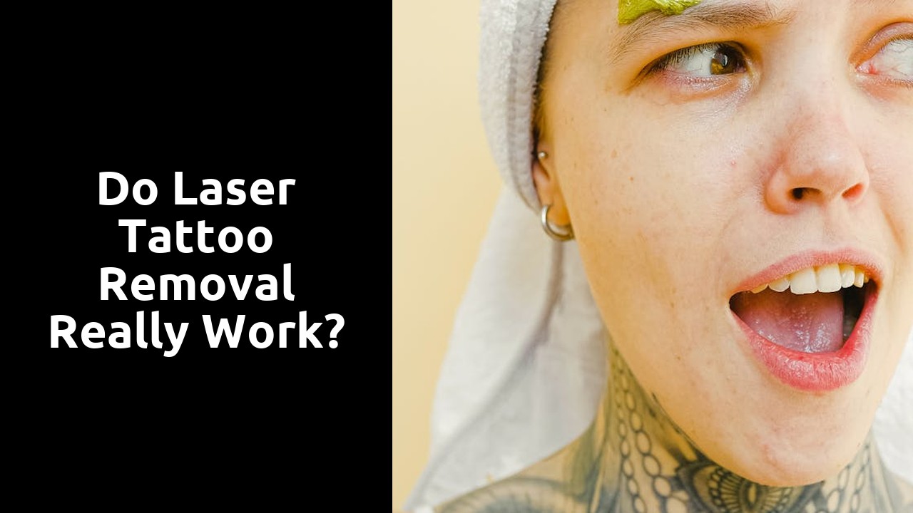 Do laser tattoo removal really work?