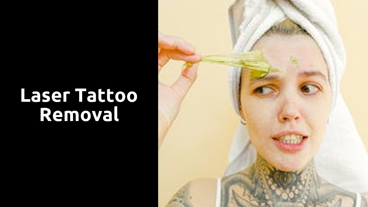 Laser Tattoo Removal