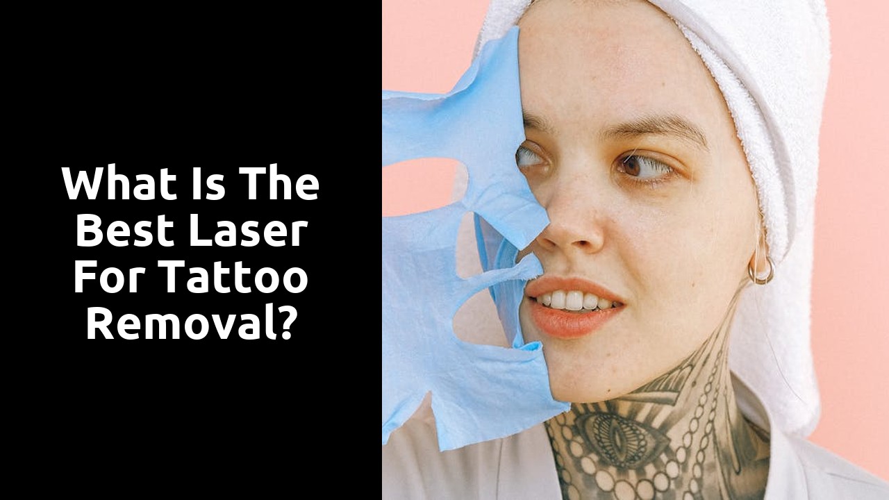 What is the best laser for tattoo removal?